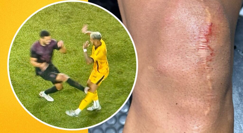 Alan Kardec machucado adversário em Athletico-PR x Amazonas (Foto: Reprodução/Amazonas)