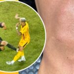 Alan Kardec machucado adversário em Athletico-PR x Amazonas (Foto: Reprodução/Amazonas)